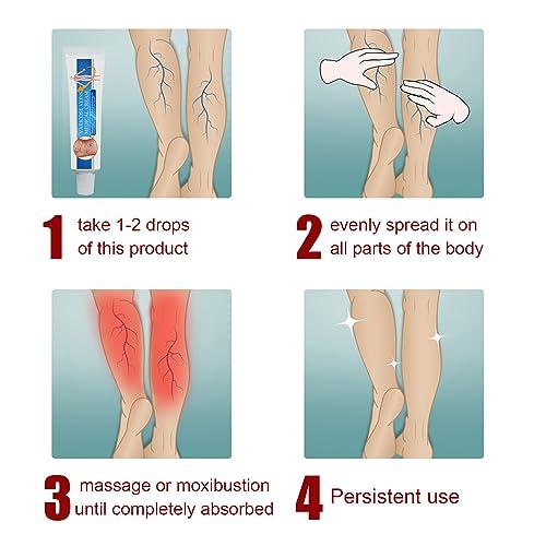 Nosbei Vericose Veins Treatment Blue Light Lazer Treatment Pen, Varicose Veins Blue Light Therapy Set, Blue Light Therapy Pen for Varicose and Spider Veins, Spider Vein Removal Lazer Pen (2cream+1pen)