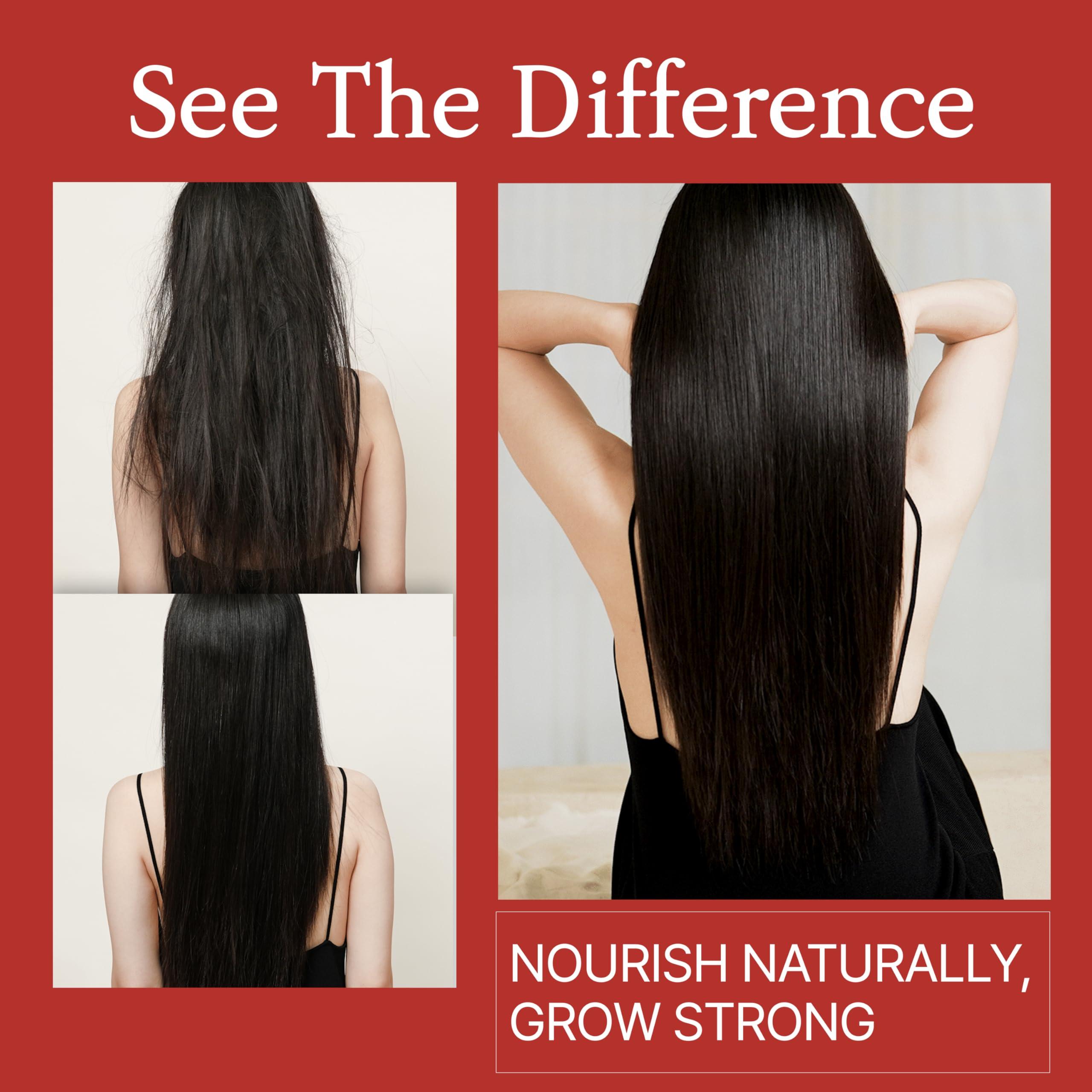 MOEV MOEV ANNURCATIN Shampoo, Biotin Hair Growth Volumizer Korean Anti Hair Loss Shampoo for Women, Build Lift, Natural Sulfate and Paraben-Free Apple Fresh Cleanser, Strengthens Weak Hair 10.14 fl.oz.