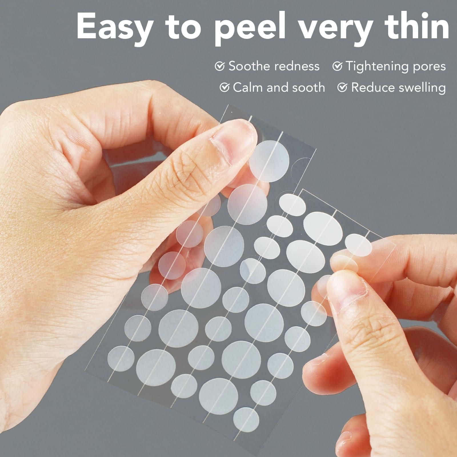 Qmakup Qmakup Pimple Patches for Face,Acne Patches for Face,Pimple Patch,Zit Patches,Hydrocolloid Blemish Patches for Covering Zits and Blemishes,with Salicylic Acid,Tea Tree oil & Calendula oil, 108 Counts