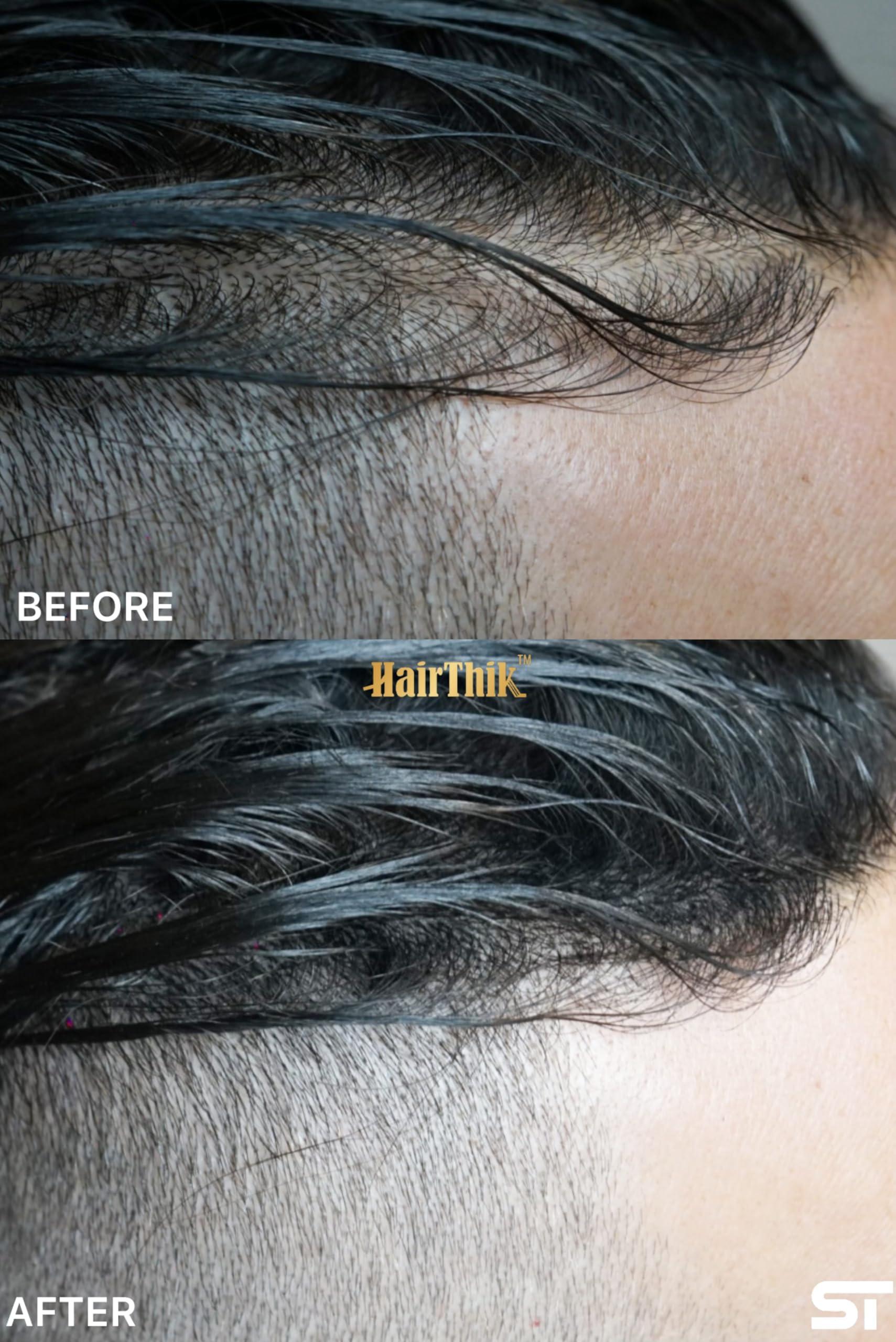 Supreme Trimmer Hair Building Fibers 8-in-1 Kit | includes 25G Keratin Fibers, Pump Nozzle, 2 Hairline Cards, S&L Shaker, Brush, Wipes, Mirror | Conceal Thicken Thinning Balding Hair | Men & Women (Black)