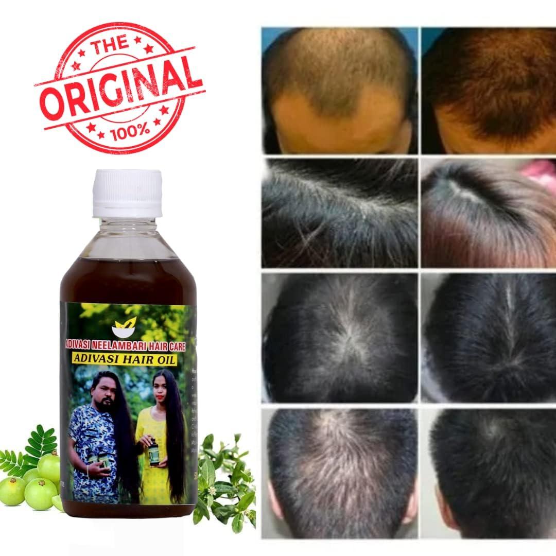 Smartdrops Adivasi Herbal Hair Oil for Hair Growth & Anti Hairfall Control | Helps Hair Thickening Hair (100ml) Pack 3