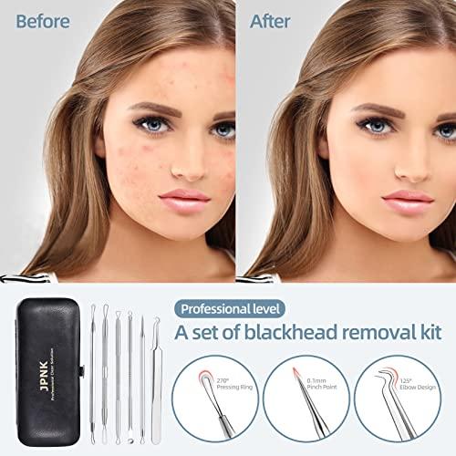 JPNK JPNK Blackhead Remover Tool Comedones Extractor Acne Removal Kit for Blemish, Whitehead Popping, 6 Pcs Zit Removing for Nose Face Tools with a Leather Bag