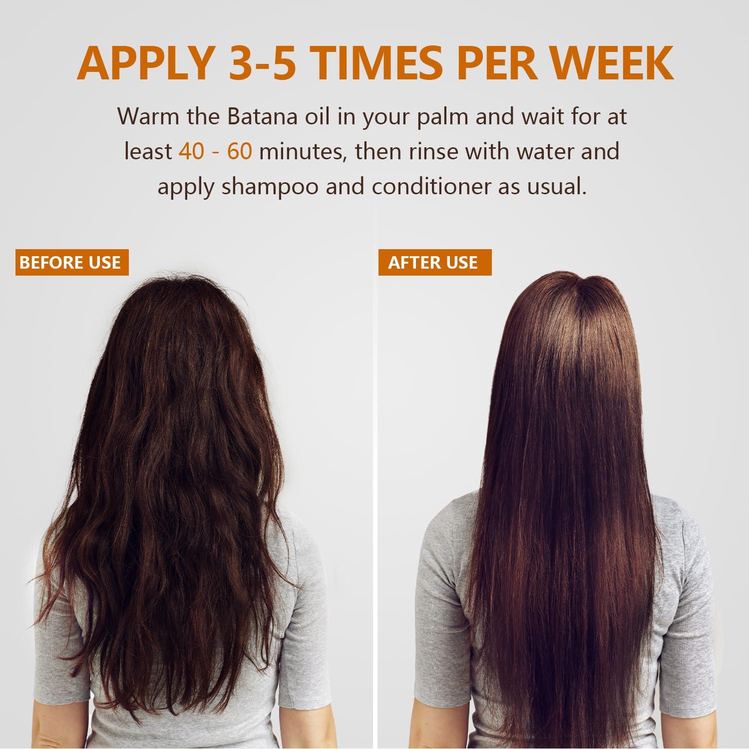 Samnyte Samnyte Dr Sebi Batana Oil For Hair Growth, Batana Oil Pure, Thickens Hair, Prevents Hair Loss For Men & Women - 4.23 Fl Oz