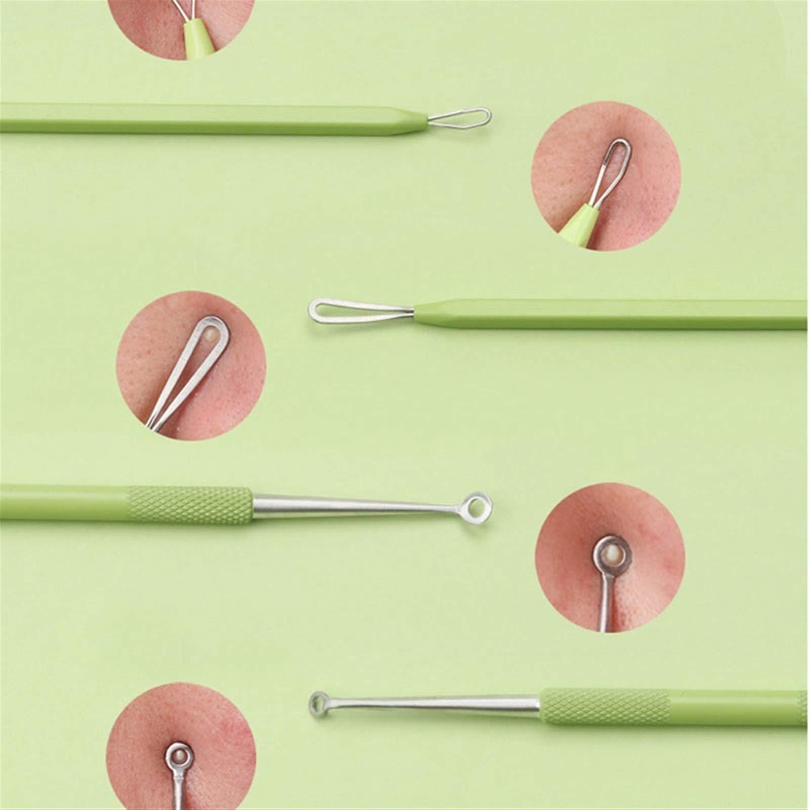 XINGTUO Pimple Popper Tool Kit 5PCS Blackhead Remover Kit Pimple Comedone Extractor Tool Set Treatment for Blemish, Zit, Acne Whitehead Tweezers Kit with 5X Magnifying Mirror Blackhead Remover Tools