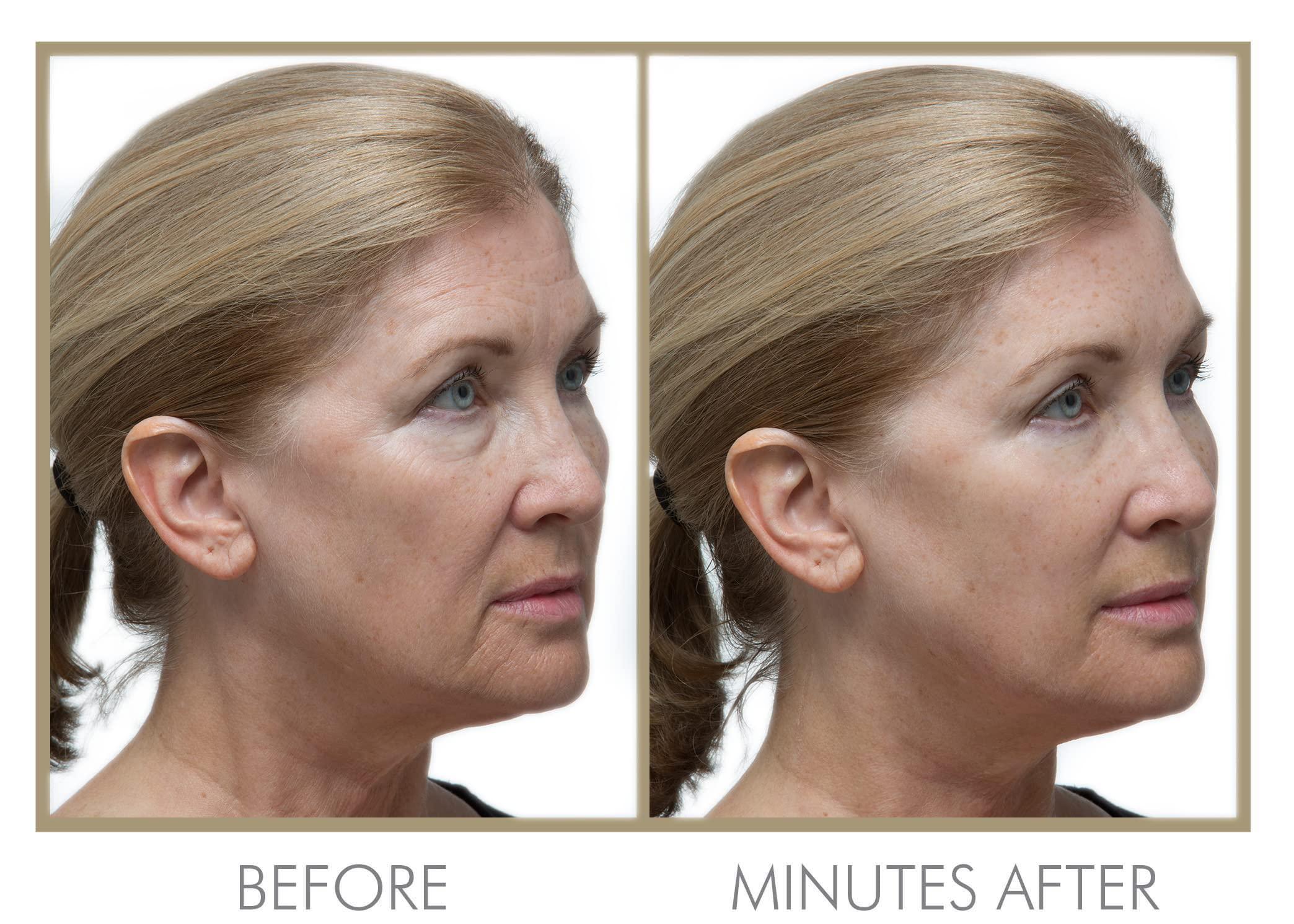 GENIE Beauty Products GENIE Instant Line Smoother (30 ml/1 fl oz)