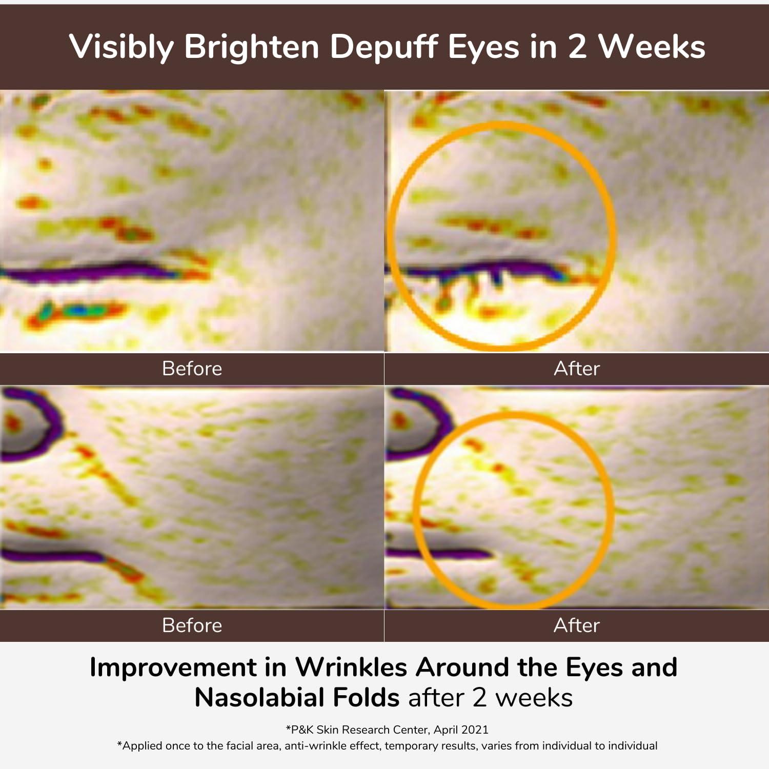 Elensilia Elensilia 80% Collagen With Gold Peptides Eye Cream - Snail Secretion Filtrate + Matrixyl 3000 + Haloxyl For Wrinkles, Dark Circles, Moisturizer - Korean Skin Care, 0.7 fl.oz