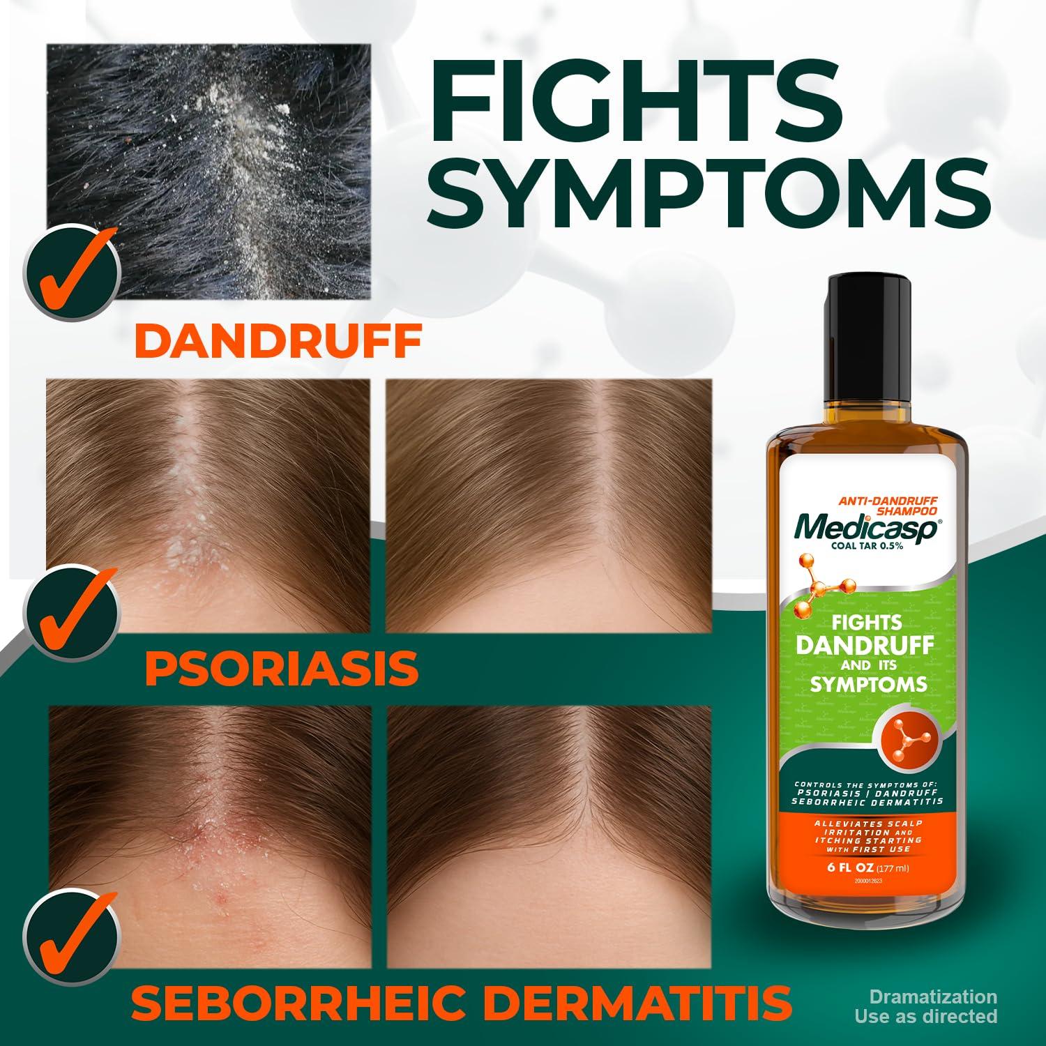 Medicasp Medicasp Coal Tar Gel Dandruff Shampoo to Treat Seborrheic Dermatitis Psoriasis, 6 Ounce (Pack of 1)