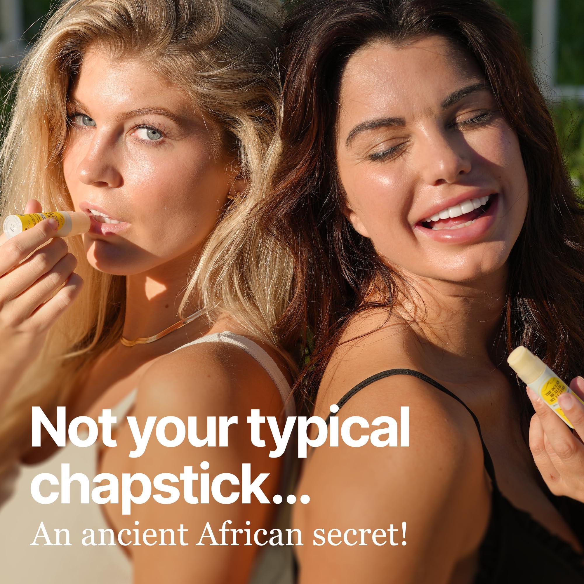 The Ocean Healed My Eczema The Ocean Healed My Eczema Nourishing & Hydrating Lip Balm - Naturally Soothing Lip Moisturizer for Eczema & Dry Cracked Lips - Moisturizing Lip Care with Mongongo Oil & Manuka Honey (.25 oz)