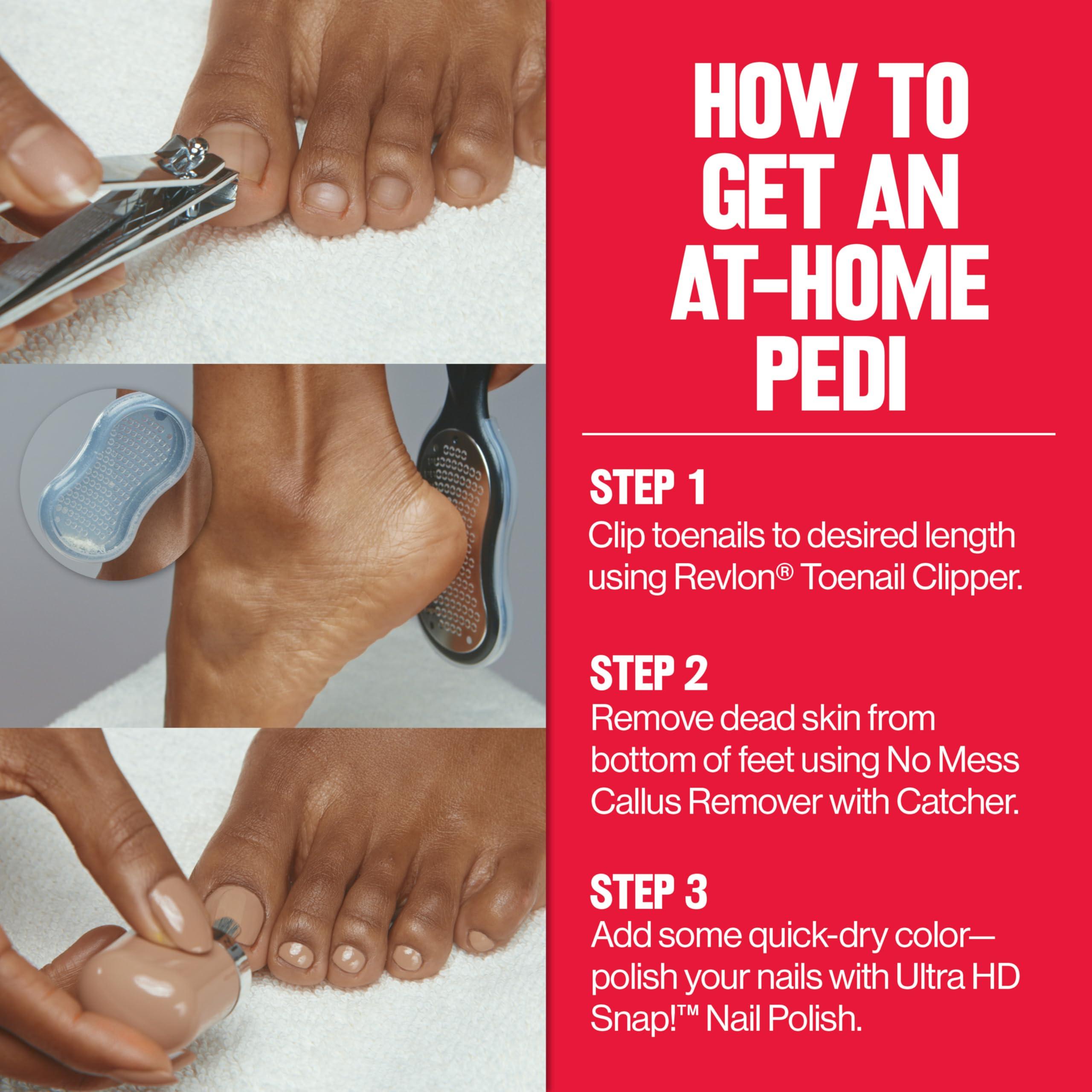 REVLON Revlon Callus Remover, Foot File for Wet or Dry Skin, Pedicure Tools,Gently Removed Callus and Dead Skin, Easy to Use (Pack of 1)