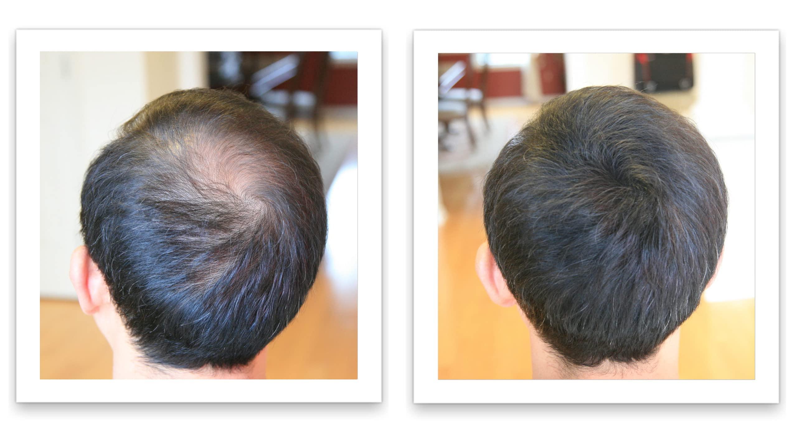 Caboki Caboki Hair Loss Concealer, All-Natural Hair Building Fiber. Make Thin Hair Look 10X Fuller Instantly. Eliminate the Appearance of Bald Spot and Thinning Hair (30G, 90-Day Supply). Black