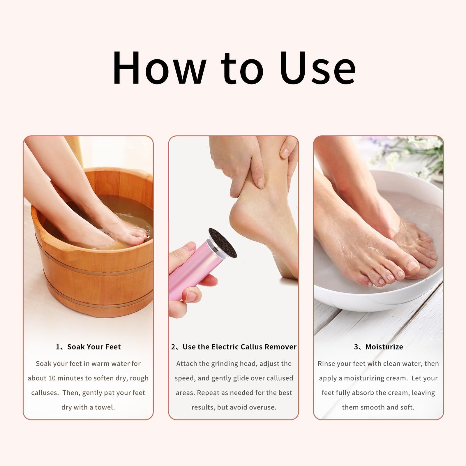 Turoco 2025 Upgraded Electric Foot Callus Remover, Best Callus Remover for Feet & Electric Foot File, Foot Scrubber for Dead Skin, Professional Pedicure Tools for Feet with 60 Sandpaper Discs