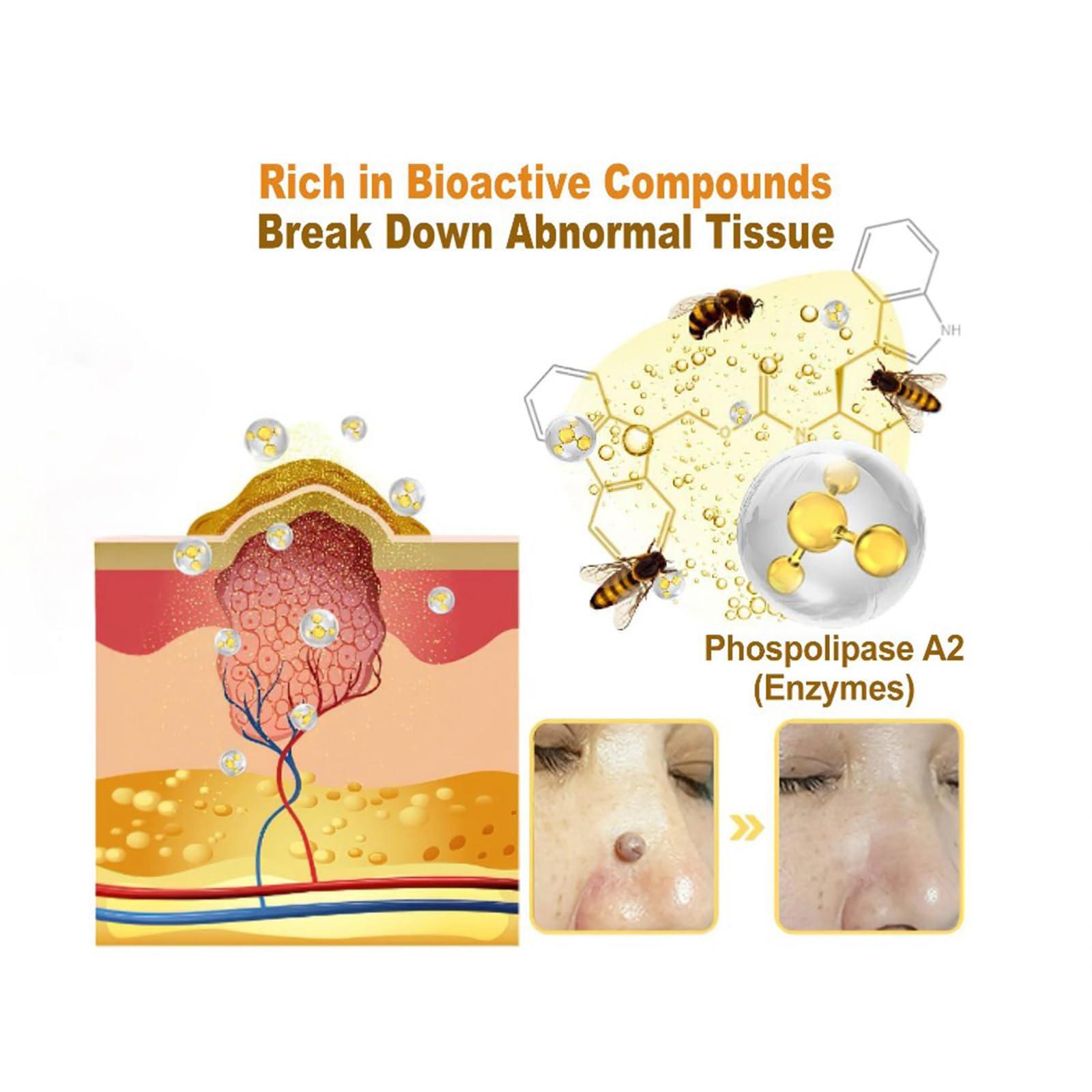 AEEHFENG Turanu Bee Venom Skin Treatment Cream, 2024 New Bee Venom Repair Cream, Turanu Professional Bee Venom Cream, Repair Maximum Strength for All Skin Types (3 Bottle)