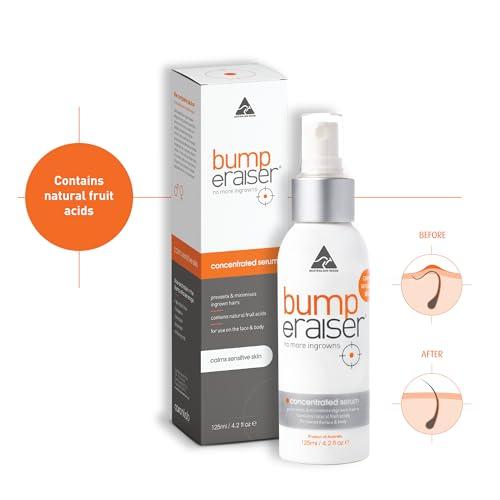 Bump eRaiser Bump Eraiser Concentrated Ingrown Hair Serum 4.2 fl oz for Ingrown Hair Treatment, Razor Burns and Razor Bumps