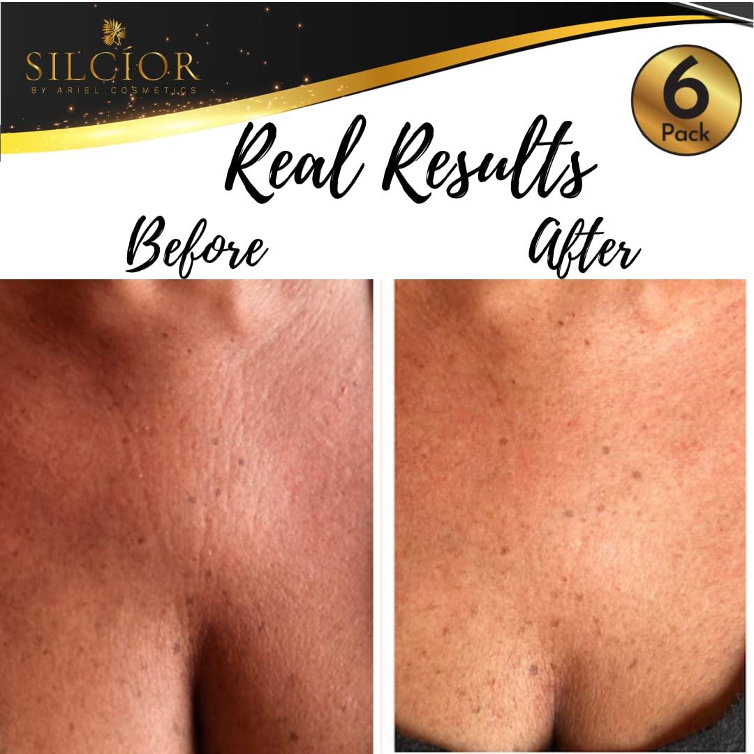 SILCÍOR SILCIOR 4 PACK Chest Wrinkle Pads, Silicone Chest Wrinkle Pad, Decollete Anti Wrinkle Chest Pads, Chest Wrinkle Pads Sleeping Reusable, Chest Patches for Wrinkles, Smoothing Pads