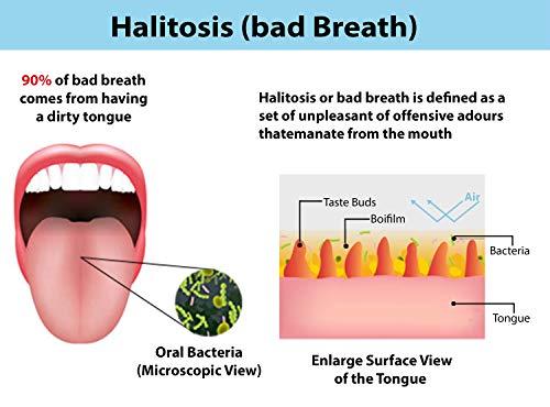 Wonder Care Wonder Care – Copper Tongue Cleaner Couples Pack | Copper Twister Cleaner | Tongue Cleaner Scraper for Adult | Ayurvedic Combo Pack Tongue Cleaner Scraper