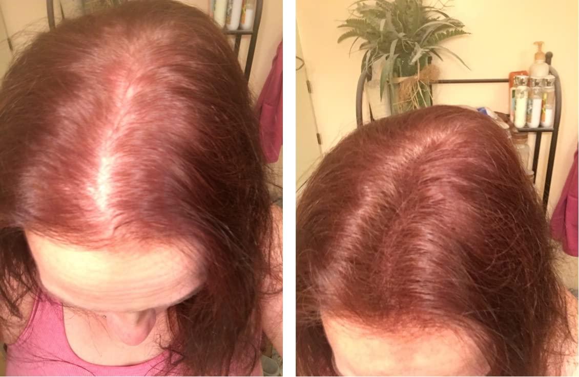 Caboki Caboki Hair Loss Concealer. All-Natural, Plant-Based Hair Building Fiber. Covers Bald Spot and Thinning Hair. Make Thin Hair Look 10X Fuller Instantly.(30G, 90-Day Supply). Light Auburn