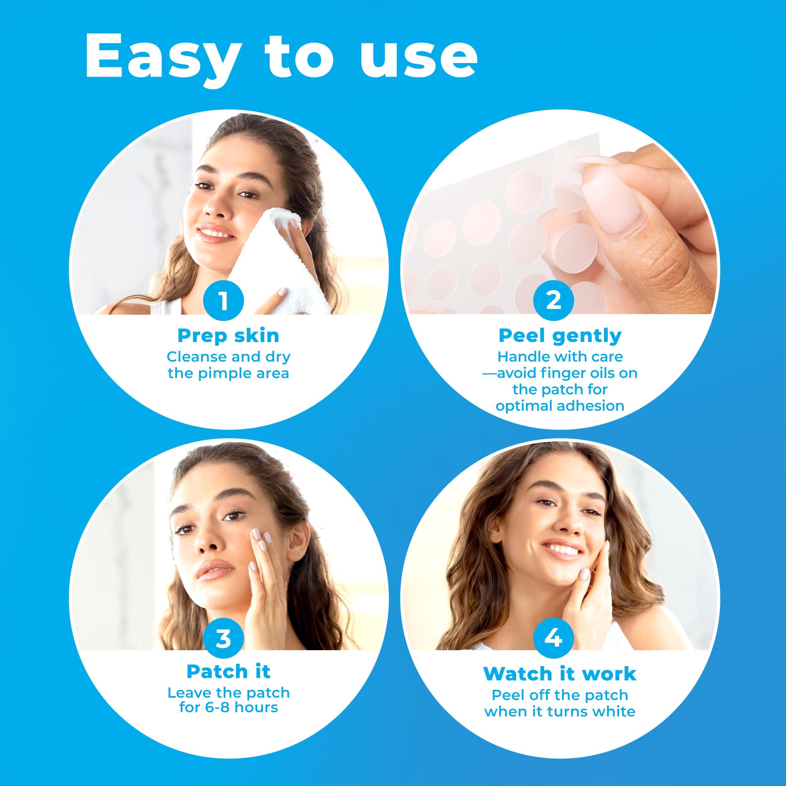 KEYCONCEPTS PatchRx Pimple Patches for Face (120 Patches), Hydrocolloid Acne Patches with Tea Tree Oil, Pimple Patch Pimple Stickers - Hydrocolloid Patch Acne Dots - Acne Pimple Patches For Face - Zit Patches