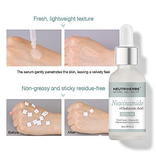 Neutriherbs Neutriherbs 4% Niacinamide Serum for Face the Ordinary + HA,Effectively Work to Control Excess Facial Oil, Minimize the Pores and Prevent Breakouts, Best Niacinamide Serum For Oily Skin