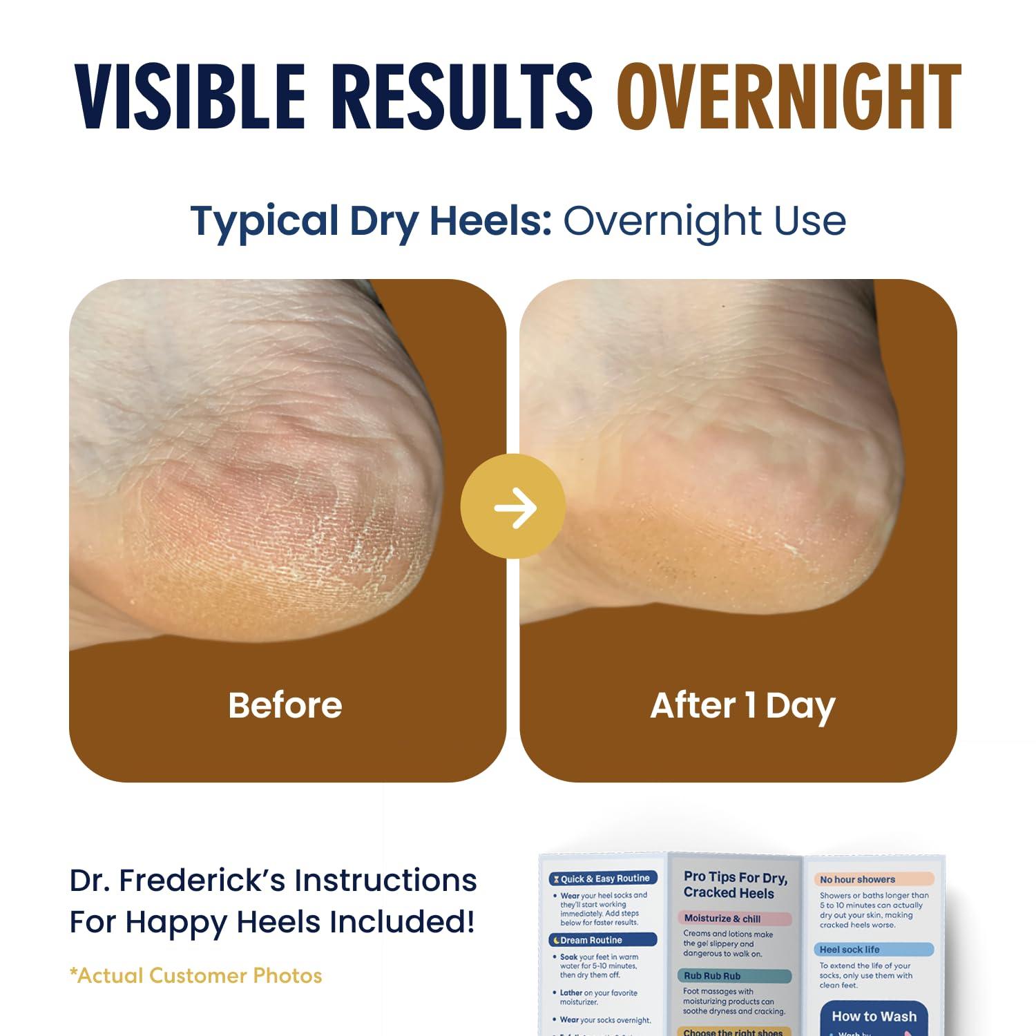 Dr. Frederick\'s Original Dr. Frederick\'s Original Moisturizing Fuzzy Heel Socks - 2 Pairs - Cozy Gel-Lined Sleep Socks for Women & Men - Soothing Dry, Cracked Feet - Cracked Heel Repair - Heal Dry Heels - Citrus Glow