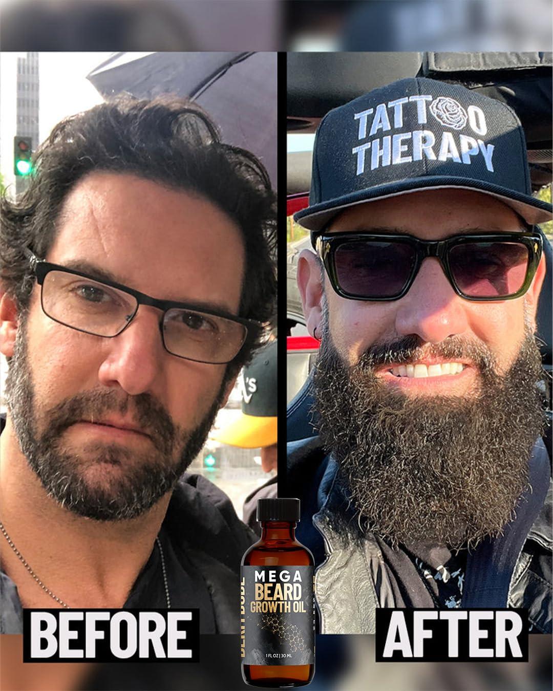 Derm Dude Derm Dude Mega Beard Growth Oil for Men | Formulated with Castor Oil & Jojoba Oil for Hair Growth | Promotes Thicker, Fuller Beard, Hydrates & Softens Facial Hair, Non-Greasy Grooming Treatment - 1 oz