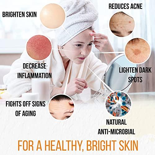 Natrulo Turmeric Soap Bar for Face & Body - All Natural Turmeric Skin Soap - Turmeric Face Soap Reduces Acne, Fades Scars & Cleanses Skin - 4 Oz Turmeric Bar Soap for All Skin Types Made in USA