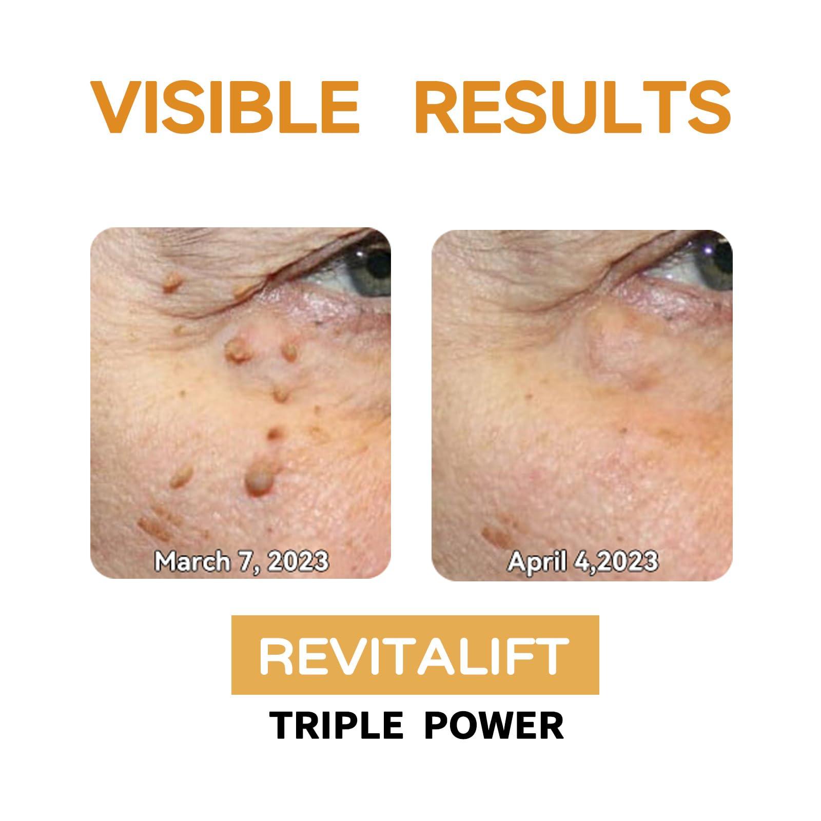 Zoencgz Bee Venom Removal Cream, New Bee Venom Treatment Cream, Professional Bee Venom Repair Cream for All Parts of The Body (4 Pack)