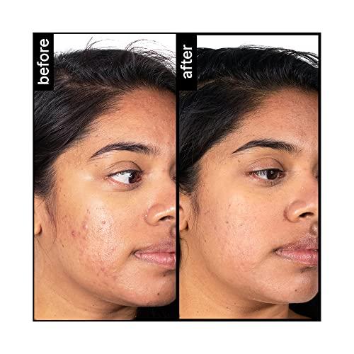 pH-In pH-In The Cleanser