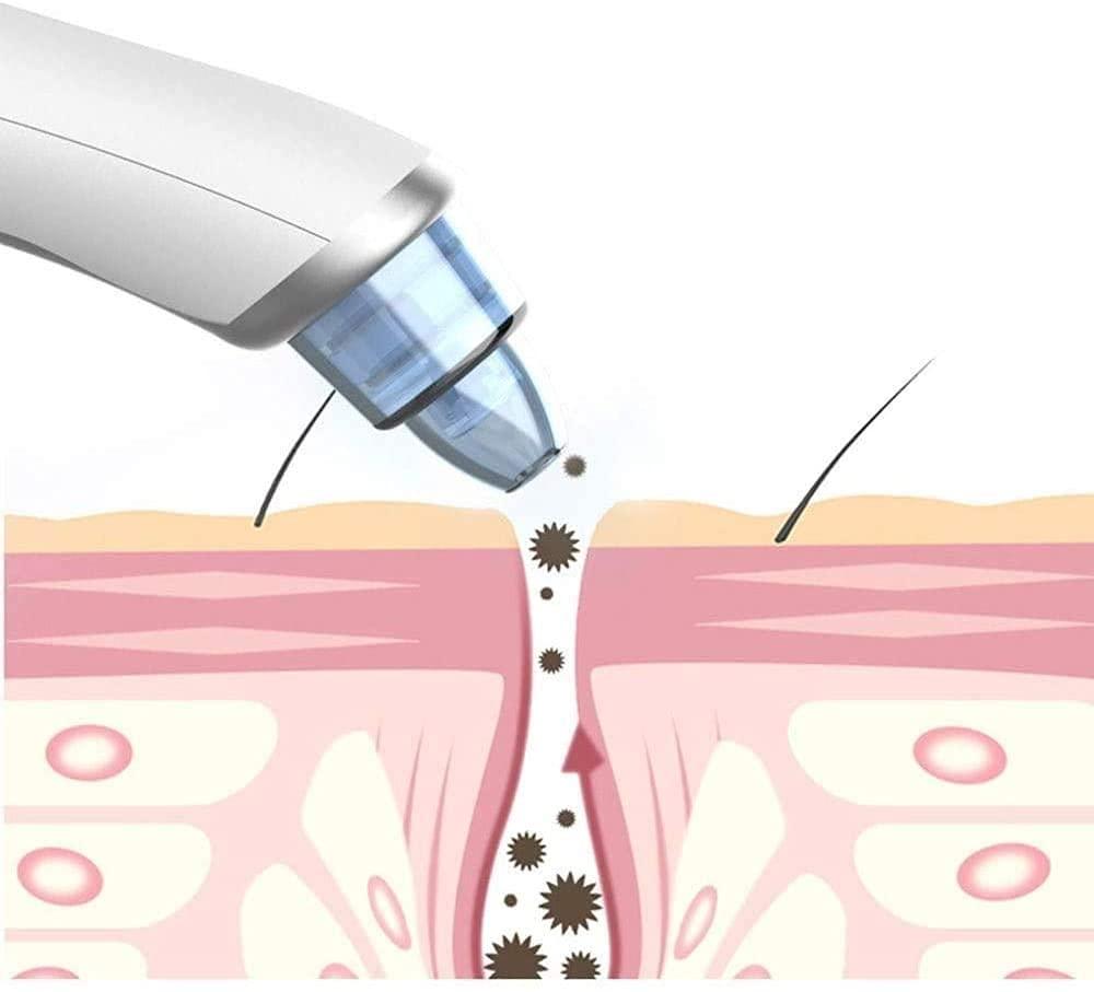 SMSOM SMSOM Blackhead Remover, Portable Blackhead Remover Vacuum-Pore Cleaner Vacuum Electric Suction Facial Comedo Acne Extractor Tool for Women & Men (White)