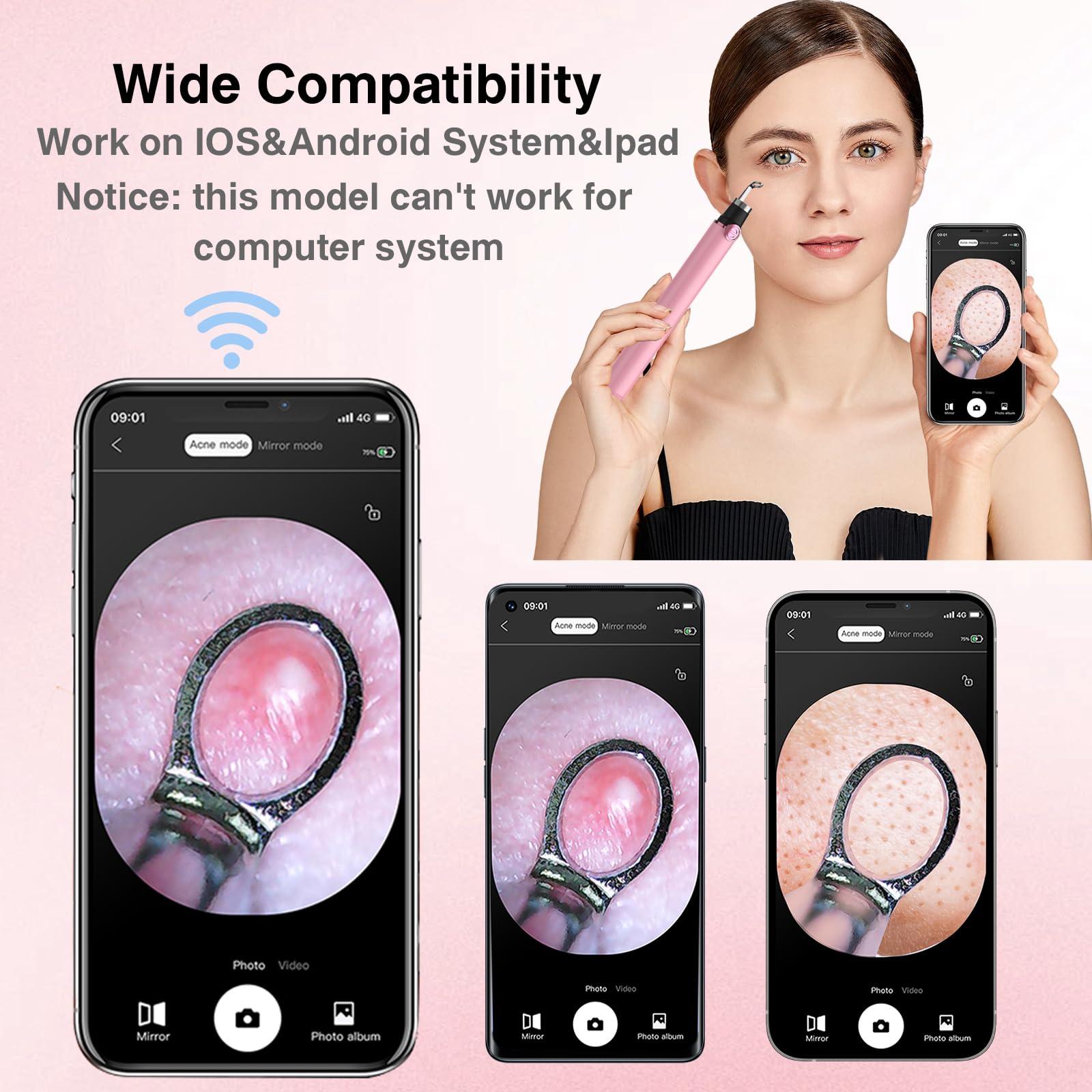 PrajnaQY Blackhead Remover Tools,Visible Pimple Popper Extractor Tool Kit with Visible Camera for Blemish, Whitehead Popping, Rechargeable Blackhead Extractor Tool for iPhone, iPad & Android (Pink)