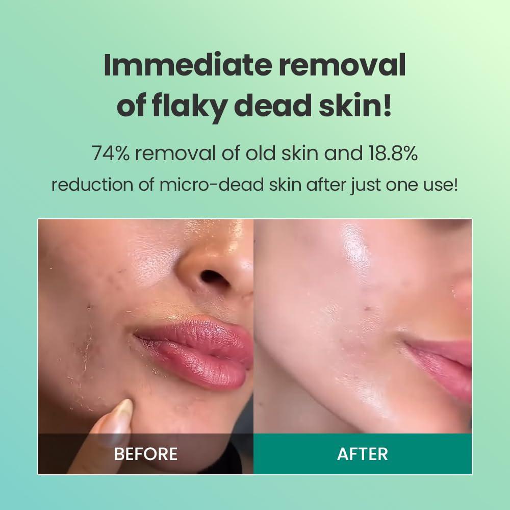 Dr.G Dr.G Korean Derma Peeling Gel, 120ml - Facial Peeling Gel For Face, Exfoliating Gel For Face, Face Exfoliator, Korean Skin Care, Korean Skincare, Korean Beauty Products, Kbeauty, K Beauty Skincare