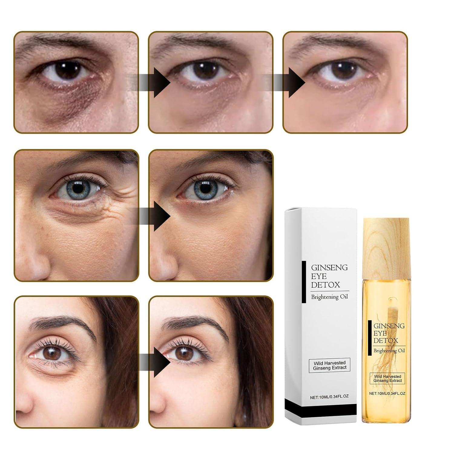 dyfgweq dyfgweq Ginseng Eye Oil Roller, Eye Repair Serum, eye cream anti aging Essential Oil for Dark Circles, Eye Bag, Puffiness, Wrinkles, with 360 Massage Ball Roller (3pcs)