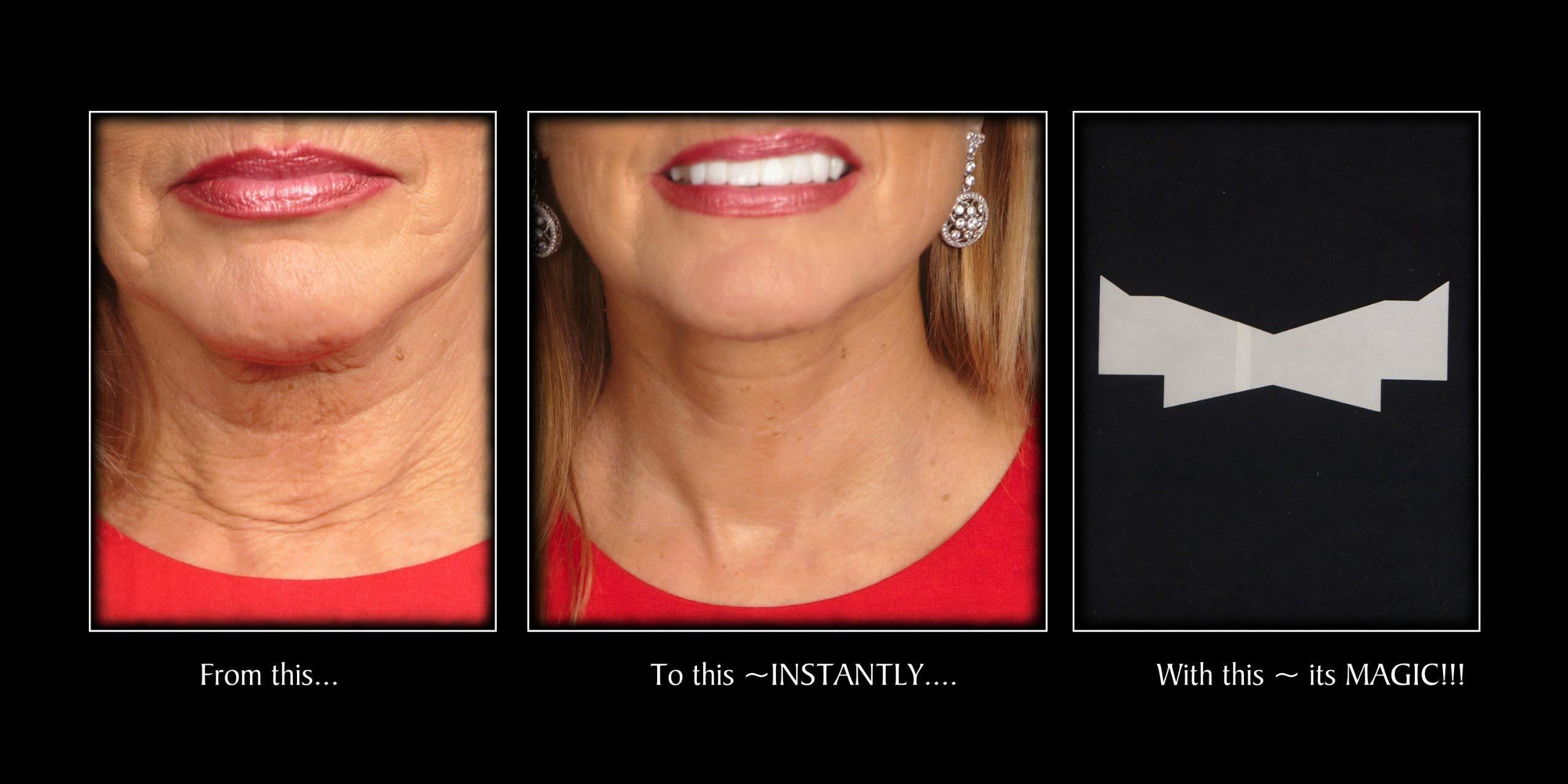 NeckTITE Magic NeckTITE Magic Instant Neck Lift, 12 Count - Smooths Wrinkles for Adults