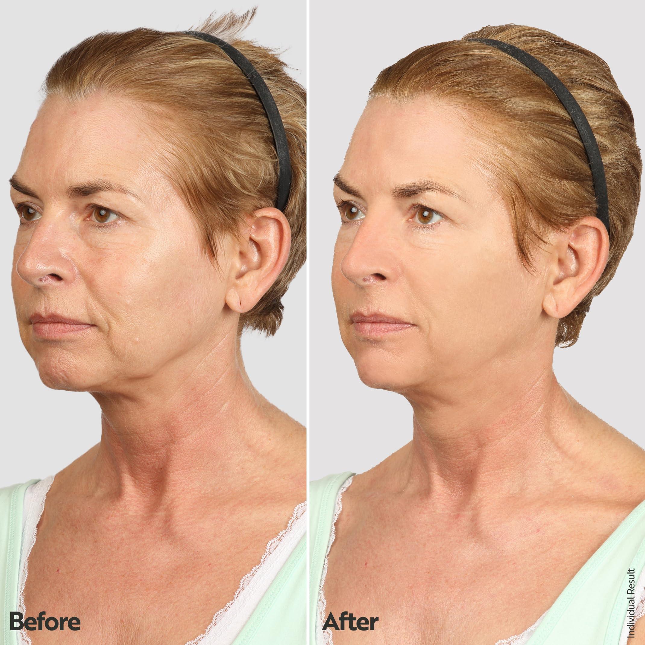 M. Asam M. Asam VINO GOLD 24h Facial Cream (3.38 Fl Oz)- 24h day cream & night moisturizer against lines & wrinkles, protection against skin aging, anti-aging, vegan facial care, skincare for women.