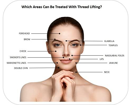 CRD Eye Care - ACE PDO thread lift KOREA - Mono Type/Blunt 30G25 (20pcs) for Eye Care (30G25/35)