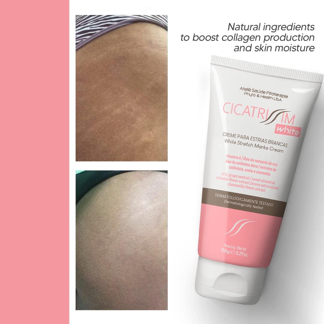Cicatrissim Cicatrissim White Stretch Mark Fade and Removal Cream - Innovative Formula With Pure and Powerful Natural Ingredients From Brazilian Flora - For All Skin Types.