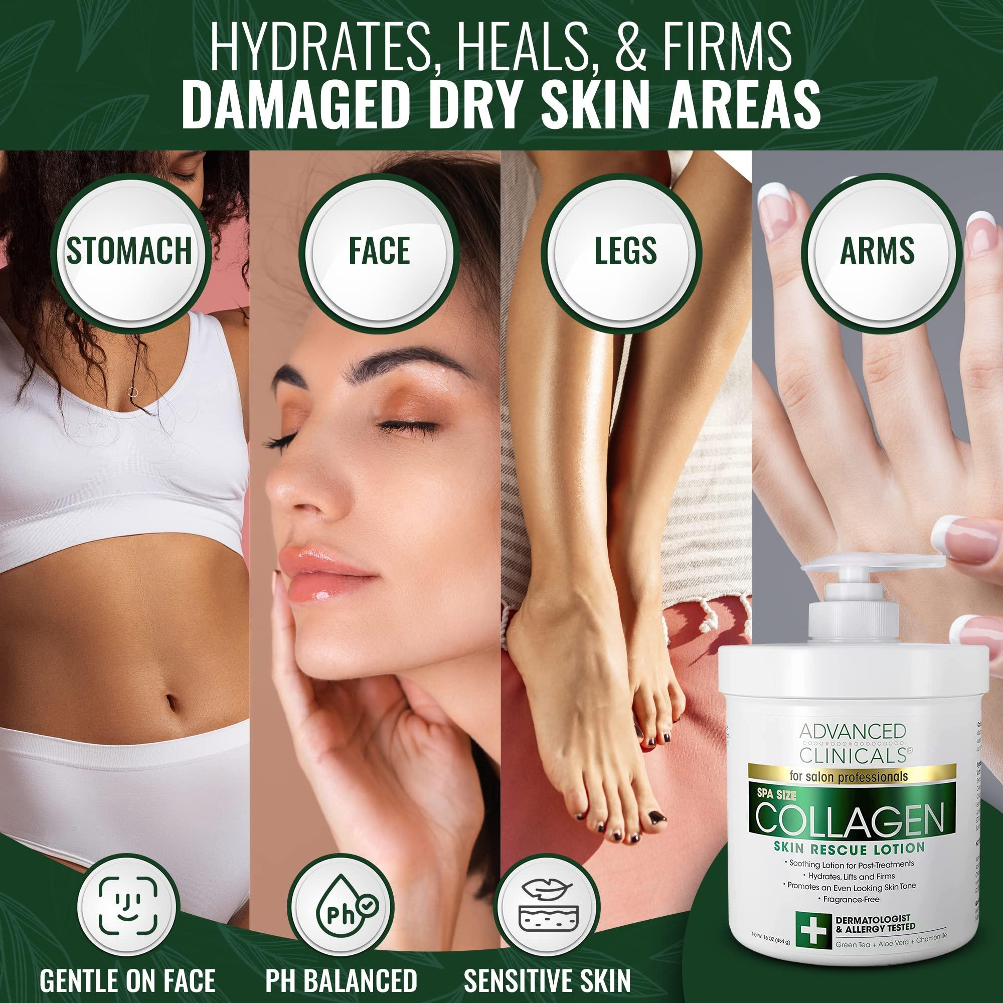 Advanced Clinicals Advanced Clinicals Collagen Skin Rescue Lotion