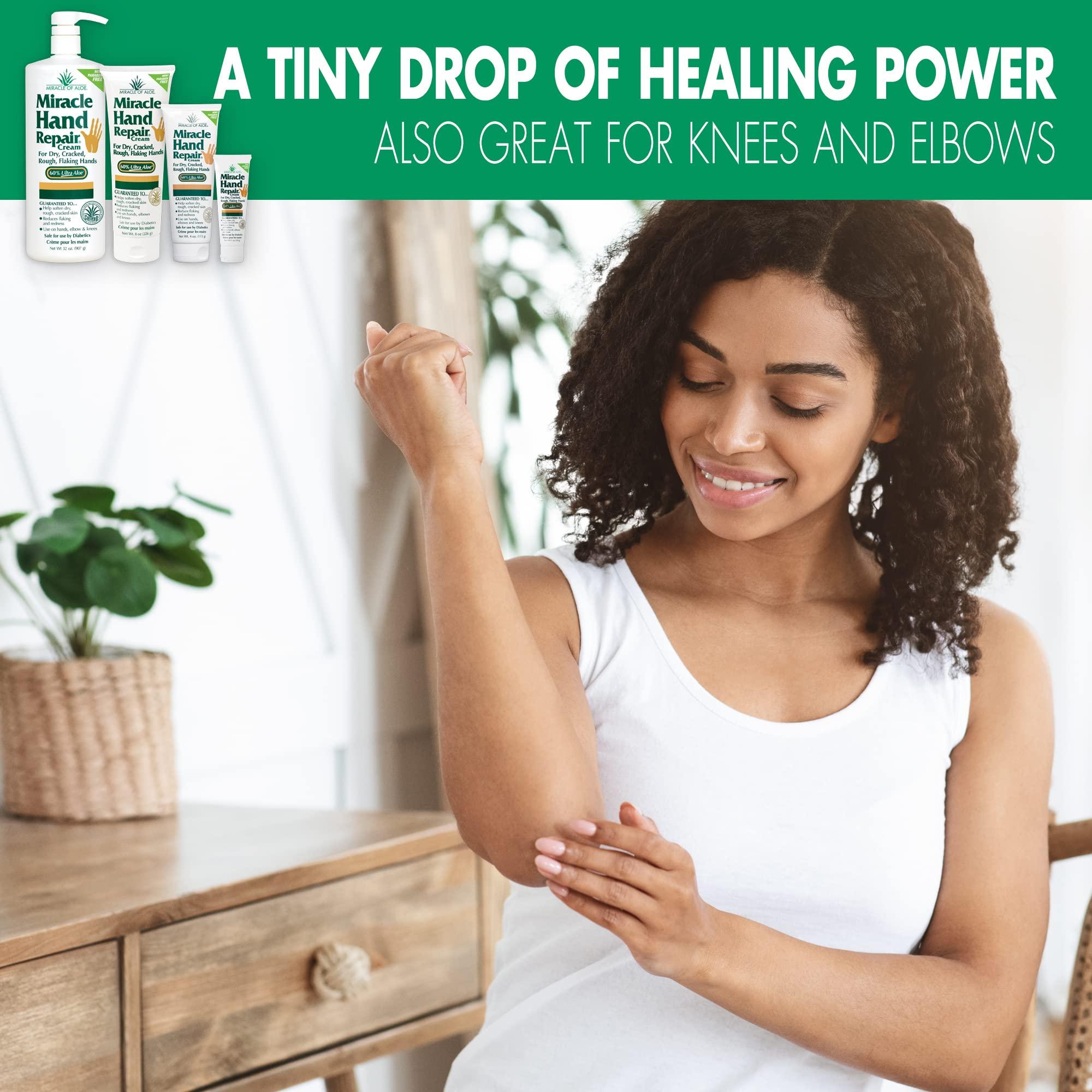 Miracle of Aloe Miracle of Aloes Miracle Hand Repair Cream 8 oz Healing Aloe Vera Lotion for Dry, Cracked Hands with 60% Ultra Aloe Gel - Moisturizes, Softens, and Repairs - Non-Greasy, Lightly Scented