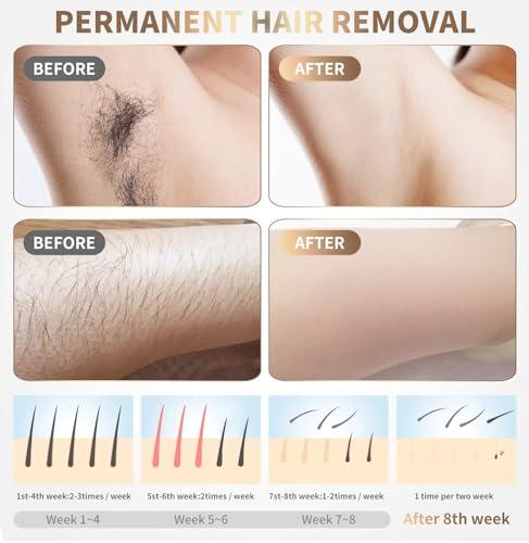 Gransumr Home Use Beauty Device IPL Laser Hair Removal for Women and Men,999999 Flashes at-Home Laser Hair Removal Device