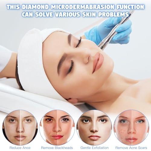 Beauty Star Upgraded 2 IN1 Diamond Microdermabrasion Machine, Beauty Star Professional Diamond Dermabrasion Facial Devices System at Home, Face Pore Cleansing Tool(65-68cmHg Vcuum Suction)