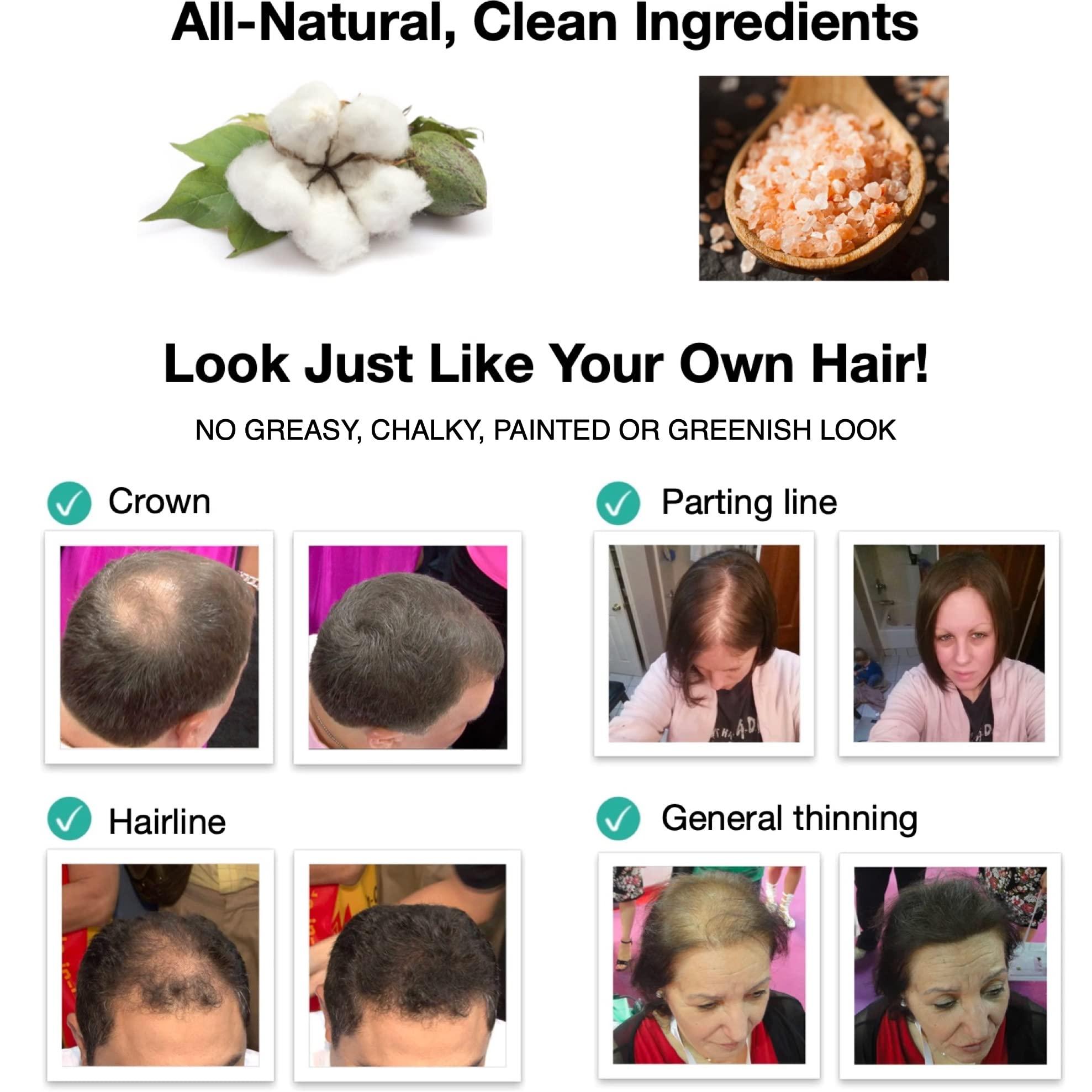 Caboki Caboki Hair Loss Concealer, All-Natural Hair Building Fiber. Make Thin Hair Look 10X Fuller Instantly. Eliminate the Appearance of Bald Spot and Thinning Hair (30G, 90-Day Supply). Black
