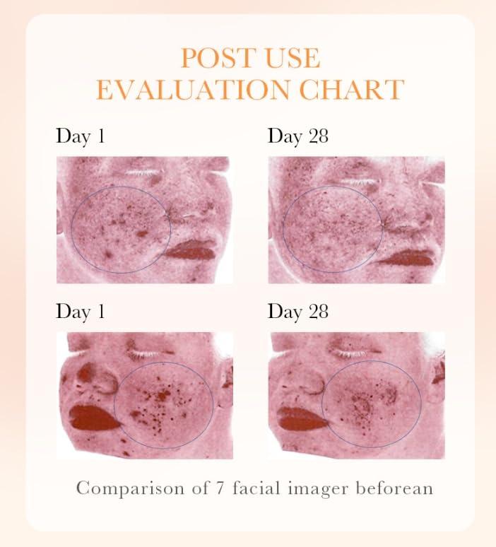 BEROZA Crema carotone para las manchas, 50G Carotone cream for Face & Body, Corrector de manchas oscuras de Caroteno,Face Moisturizer Cream