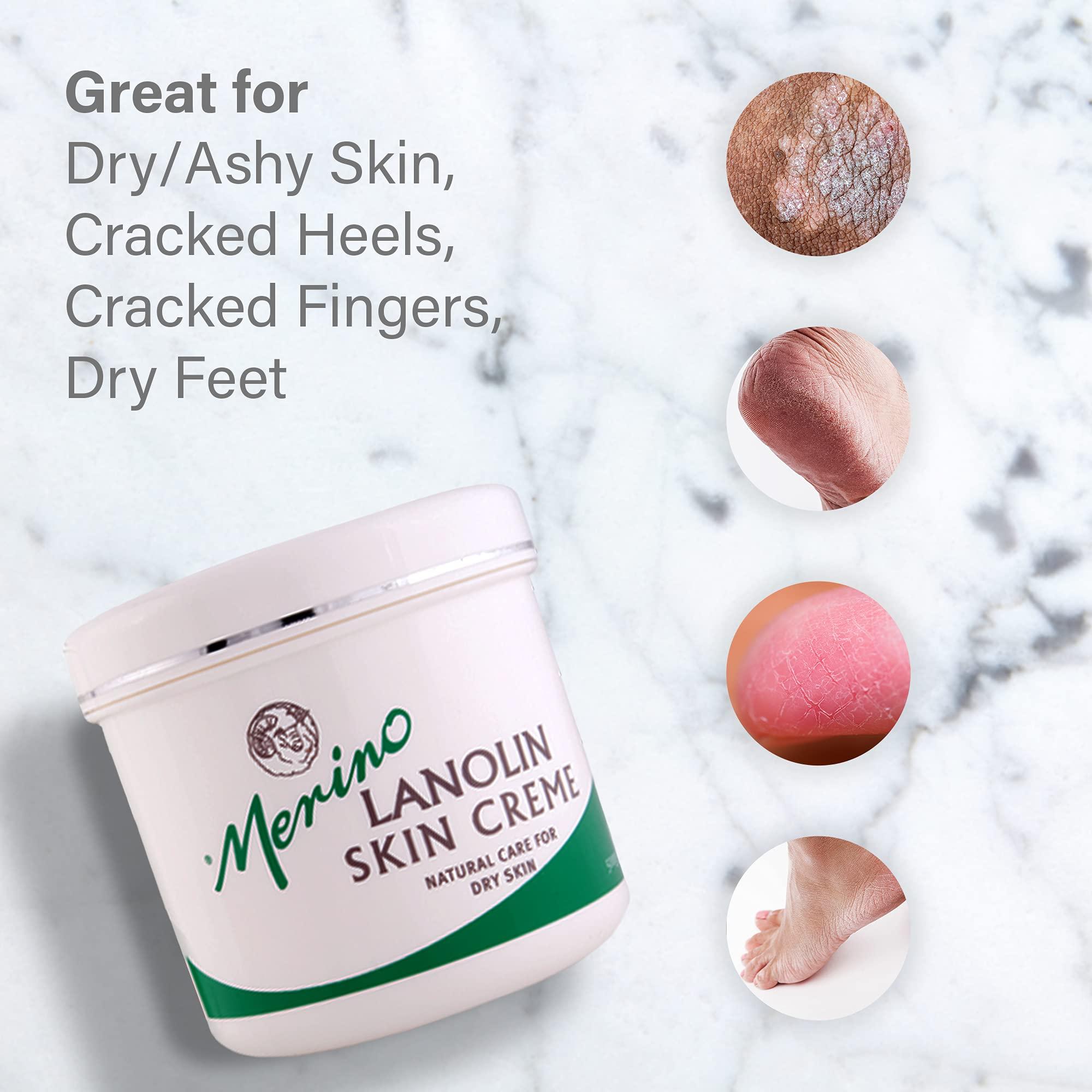 Merino Skin Care Dry Skin Lanolin Cream for Cracked Heels, Elbows and Soft Hands (500g/17.63 oz) Large Jar