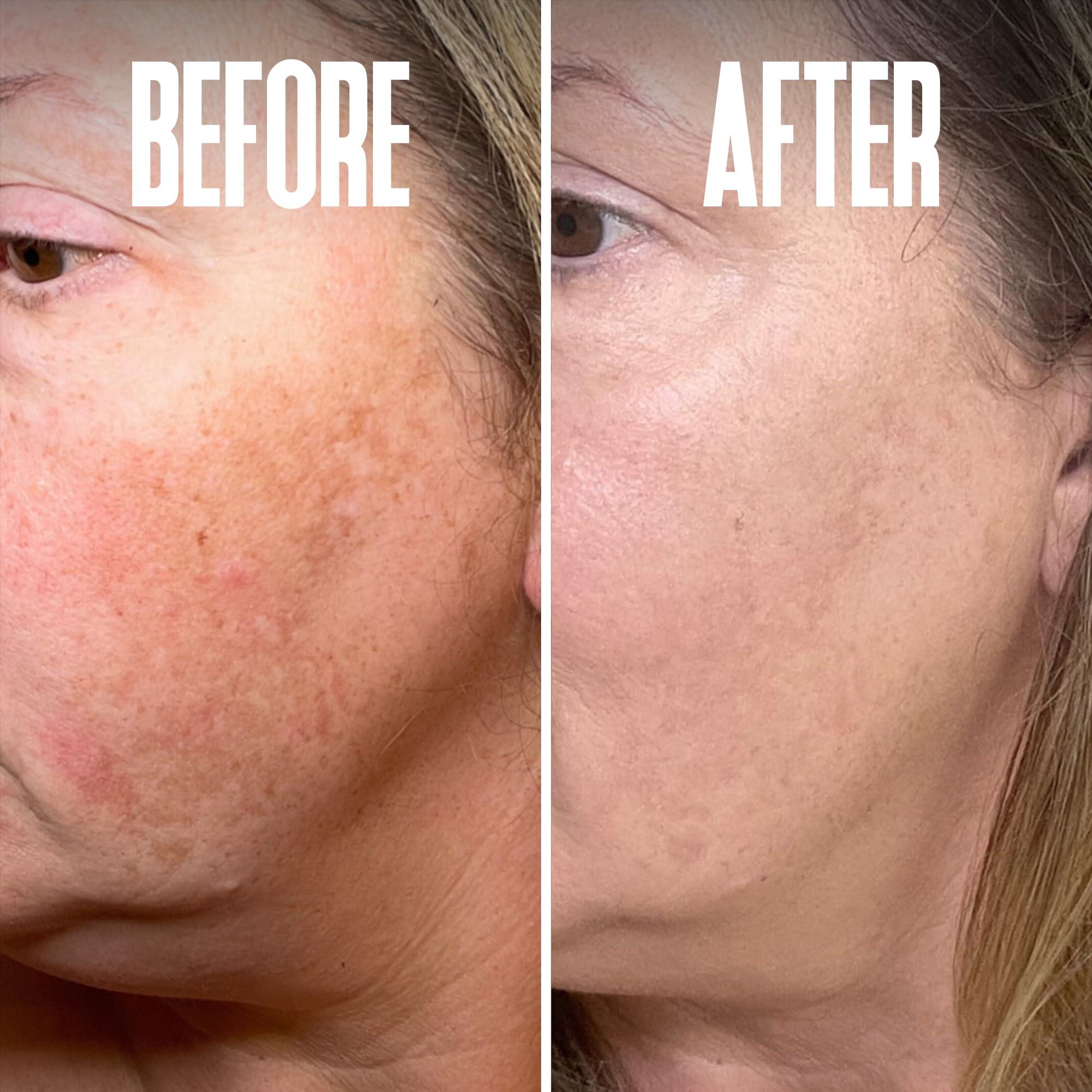 Divine Derriere Save 18% on The Skin Care Solution For Dark Spots, Razor Bumps, Ingrown Hair & Razor Burns – Includes Our Ultra Potent Brightening + Razor Bumps Pads For an Ultra Clear & Glowing Skin