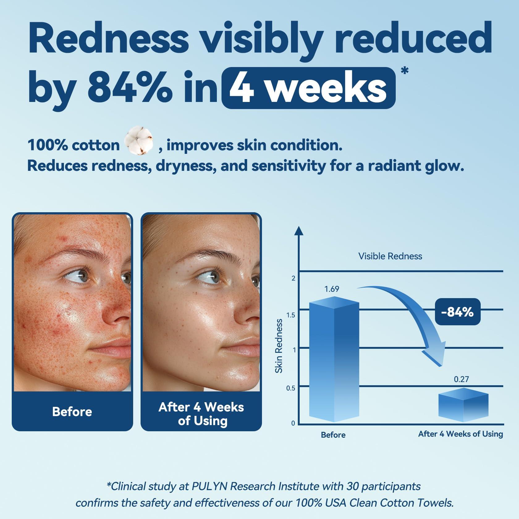 Winner Winner Soft Face Towels, Upgraded Thicker 100% USA Cotton Dry Wipes, Unscented and Gentle on Sensitive Skin, Disposable Makeup Remover and Facial Towelettes (240 Count, Pack of 3)