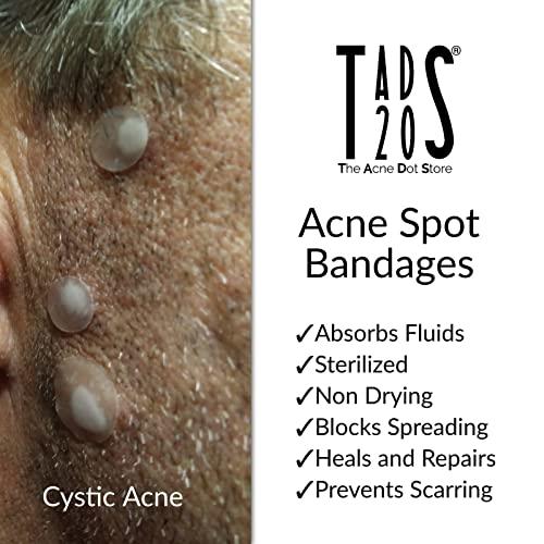 The Acne Dot Store 3pk, [120] Acne Dot Pimple Patches [SMALL SIZE] Cystic Acne Patch, FACE Spot Dots, Zit Sticker, Hydrocolloid Bandages, Blemish Spot Treatment, tads20