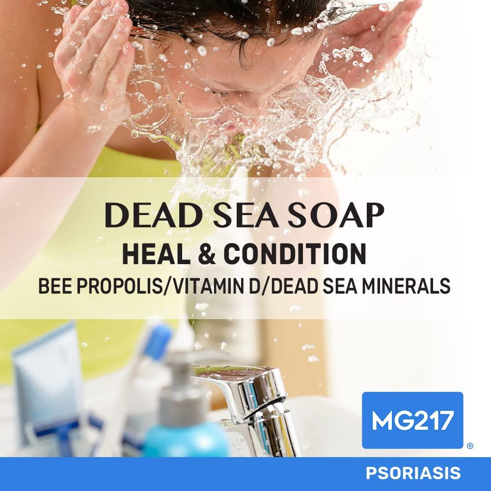 MG217 MG217 Psoriasis Dead Sea Exfoliating Bar Soap, Heal & Condition with Dead Sea Salt, Bee Propolis, Vitamin D3 for Psoriasis Skincare, 5oz (Pack of 2)