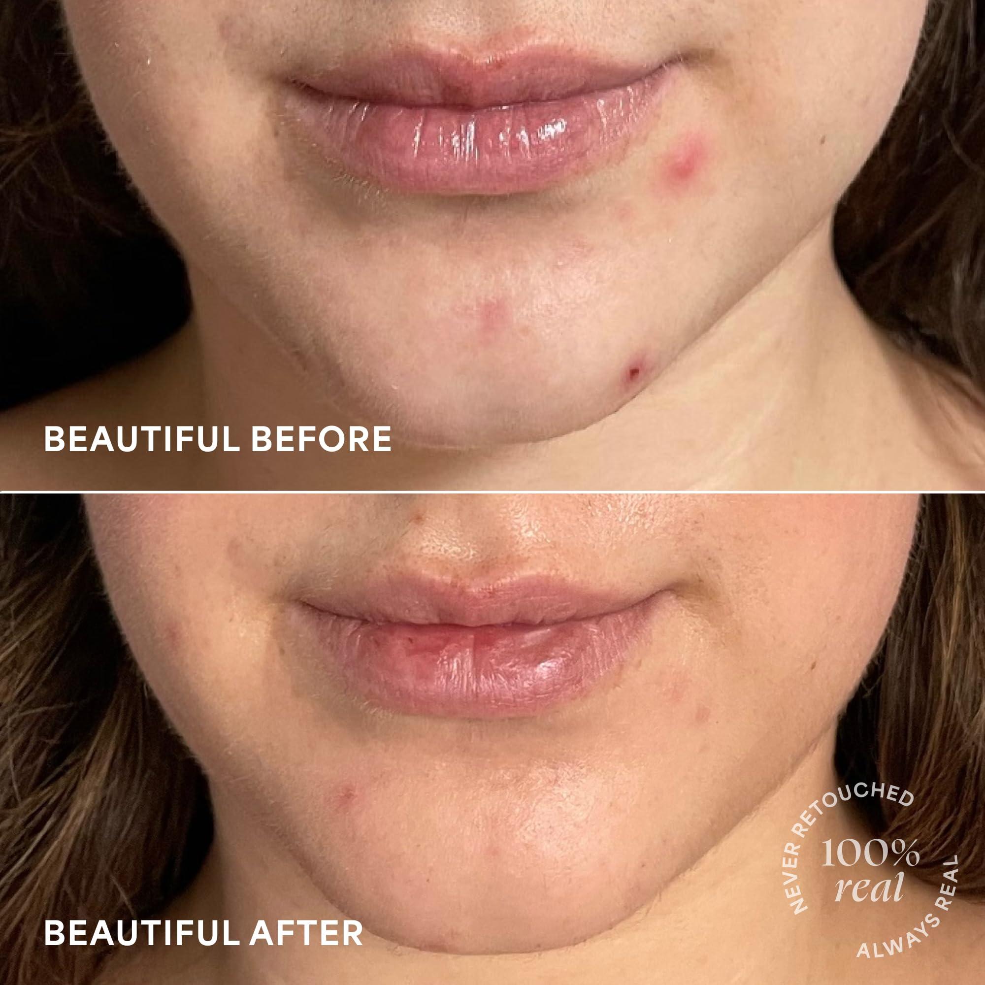 TULA TULA Skin Care Brightening Treatment Drops - Vitamin C Serum, Brightens the Look of Dull Skin & Dark Spots, 1 fl oz.