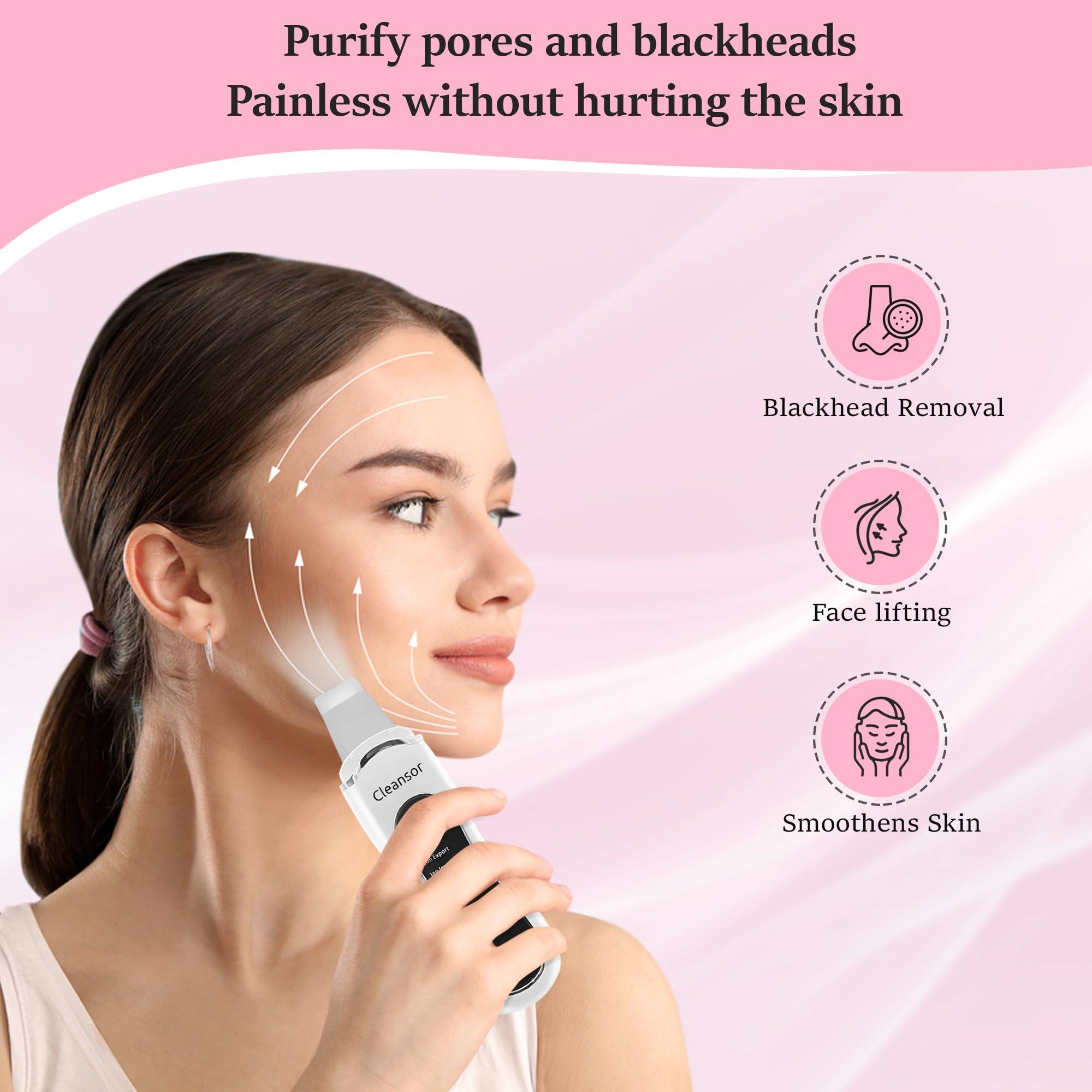 Cleansor Skin Scrubber Pore Cleaner Blackhead Remover Facial Spatula with Clean, Ion and Lift Modes
