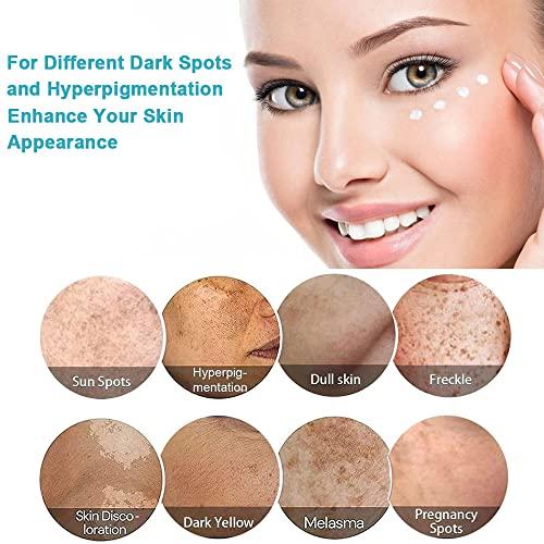 SWETIYOU Dark Spot Remover for Face, Fast-Acting Dark Spot Corrector Remover for Face and body Hyperpigmentation, Fades Melasma, Freckle, Sun Spots, Evens Skin Tone, Age Spot Remover for Women Men