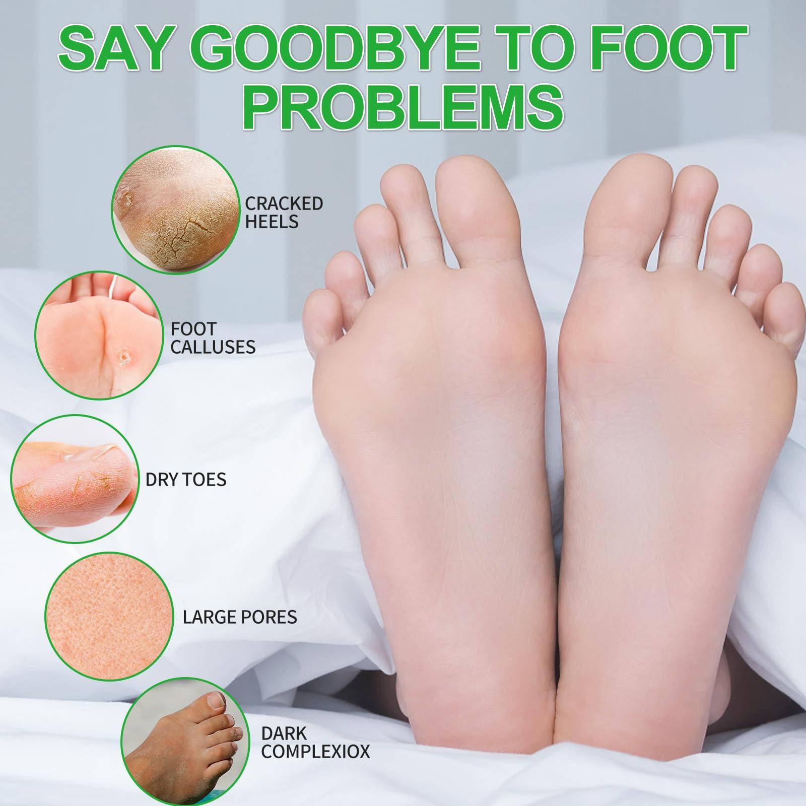 Provon Provon FMX-12 Foam Soap Dispenser, Dove Gray 6 per Carton